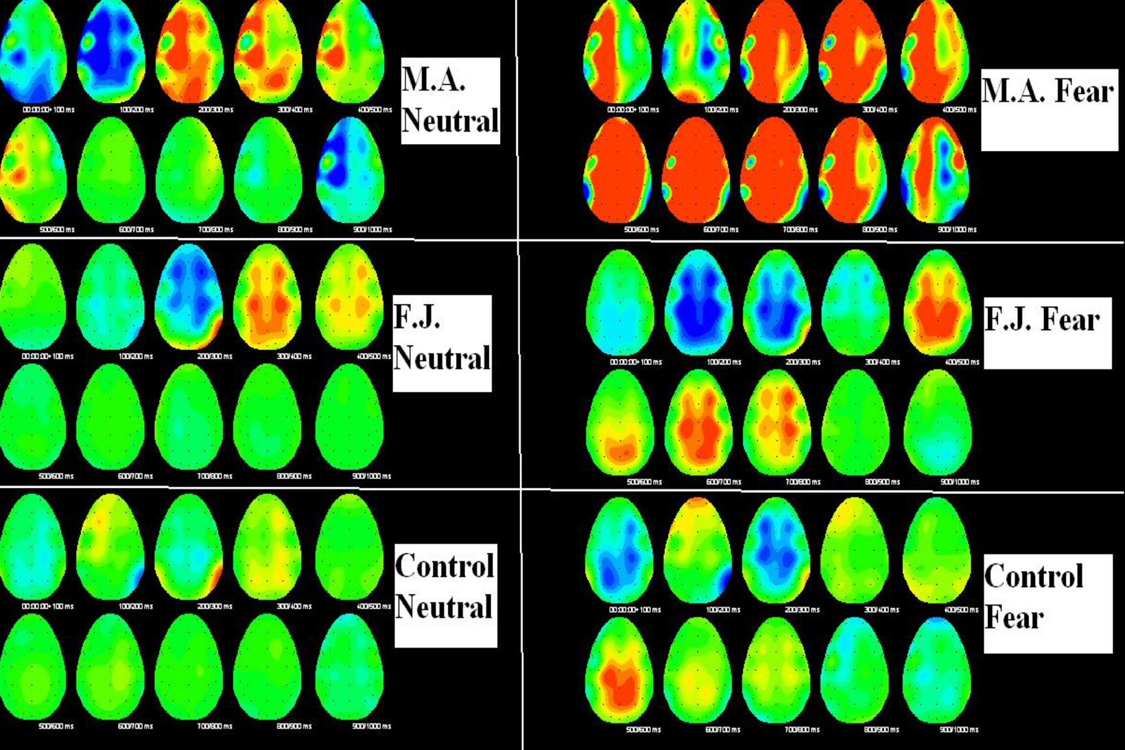 EEG+Autism+and+Controls